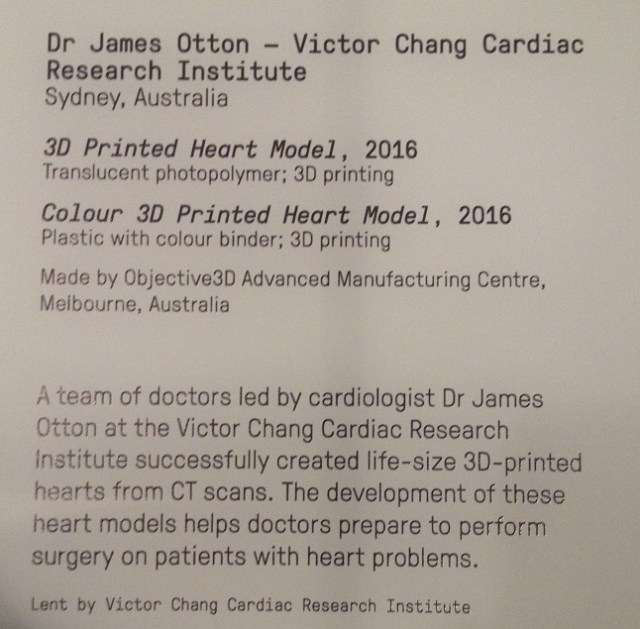 3d-printed-heart-model-2